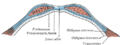 Diagram of sheath of rectus