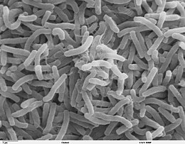 Cholera-bakterieë onder 'n mikroskoop.