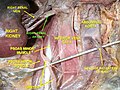 Arteră renală