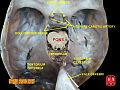 Daxili yuxu arteriyası