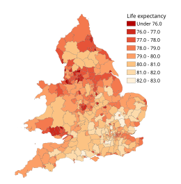 Life expectancy at birth for boys in 2012-2014 by local authority district in England and Wales.