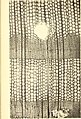 Image 33A thin transverse section showing the internal structure of conifer wood (from Conifer)