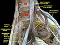 Lumbar and sacral plexus. Deep dissection. Anterior view.