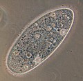 Paramecium aurelia, một nguyên sinh vật thuộc ngành trùng lông. Hình chụp dưới kính hiển vi quang học