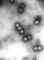 Virus: Gamma phage napadající bakterii Bacillus anthracis