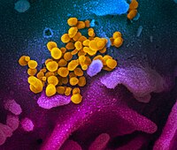 SARS-CoV-2 emerging from a human cell