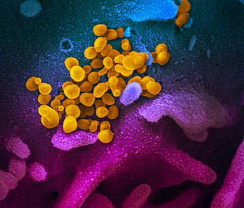 Hình ảnh kính hiển vi điện tử quét cho thấy SARS-CoV-2 (màu vàng) nổi lên từ bề mặt tế bào (màu xanh/hồng) được nuôi cấy trong phòng thí nghiệm.