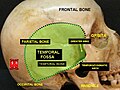 Orbital cavity