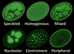 Main antinuclear antibody patterns on immunofluorescence.