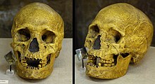 Photo d’un crâne, pris de face et de trois-quart face.