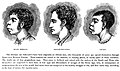 Exemple de classificacion racialista dau sègle XIX entre una raça « superiora », una sosraça blanca « inferiora » e lo Negre amb un tèxte explicatiu sus l'inferioritat deis « Iberoirlandés ».