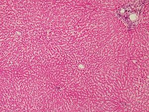 Гистологический препарат тканей печени человека, окраска гематоксилин-эозин.