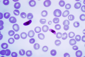 Мазок крови с Plasmodium falciparum