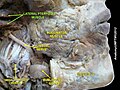 Medial pterygoid muscle