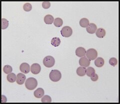 Mycoplasma haemofelis