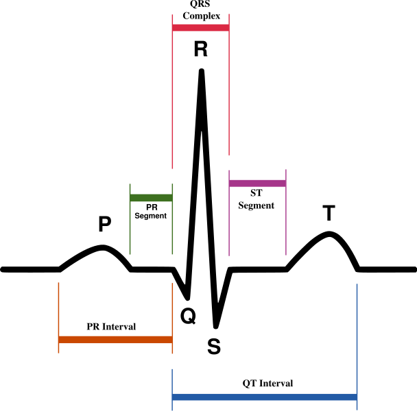 فائل:ECG.png