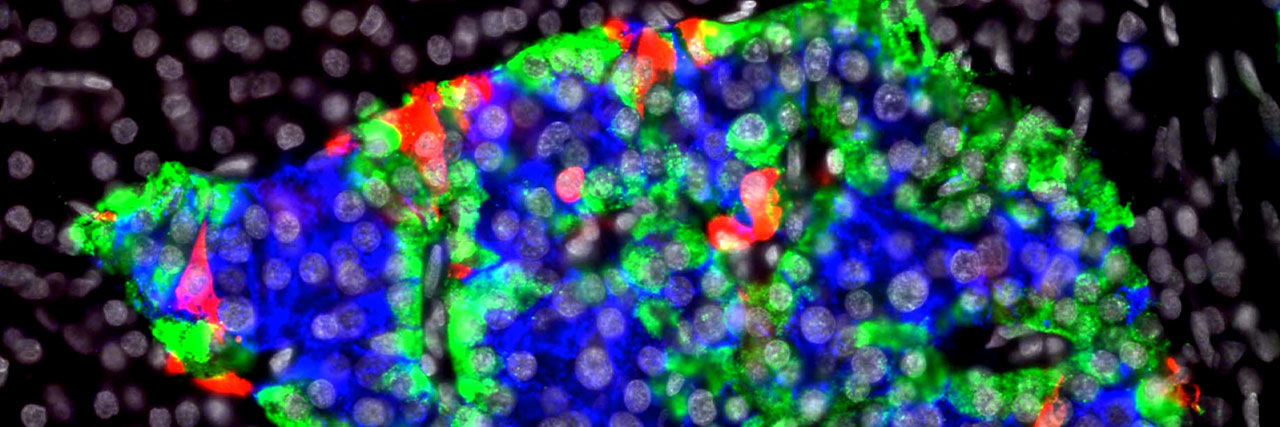 Composite light micrograph of a pancreatic islet with different fluorescent stains: insulin (beta or B cells, colored blue), glucagon (alpha or A cells, colored green), and somatostatin (delta or D cells, colored red)