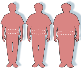 Степени ожирения: силуэты людей с нормальной, избыточной массой тела и с ожирением.
