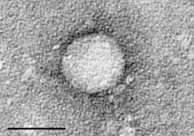 Электронная микрофотография "Вируса гепатита C", очищенного от клеточной культуры. Размер  = 50 нанометров