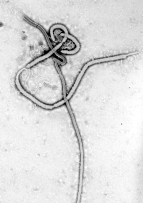 Ebolavirus