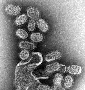 Микрофотография вируса гриппа, снятая при помощи просвечивающего электронного микроскопа, увеличивающего примерно в сто тысяч раз
