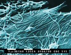 Virus Ébola (Filoviridae)