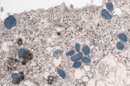 Human 293T cells infected with Clade IIa Mpox (blue) reveals mature virions on the cell’s plasma membrane and within the cytoplasm. Mature virions appear both compartmentalized and unrestricted within the cytoplasm.