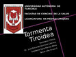 Research paper thumbnail of Tormenta Tiroidea