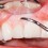 Лікування захворювань ясен та зубів у стоматології Арбор