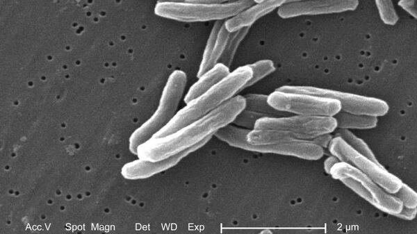 Возбудитель туберкулеза - бактерия Mycobacterium tuberculosis. Архивное фото