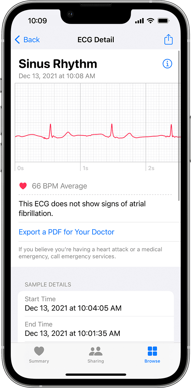 ios15-iphone13-pro-heart-browse-ecg-results-summary