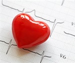 Study discovers link between a breakdown product from excess niacin and heart disease