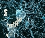 Graphene oxide offers a promising new approach to treating Alzheimer's disease