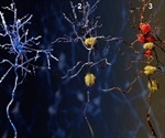 Study finds promising new target for the treatment of Alzheimer's disease