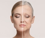 Discrimination linked to accelerated biological aging