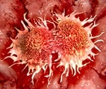 Mainz Biomed seeks FDA’s Breakthrough Devices Designation for advanced colorectal cancer test