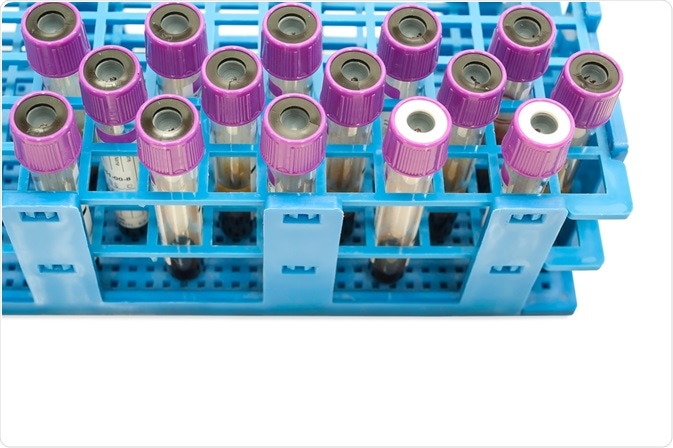 flow cytometry