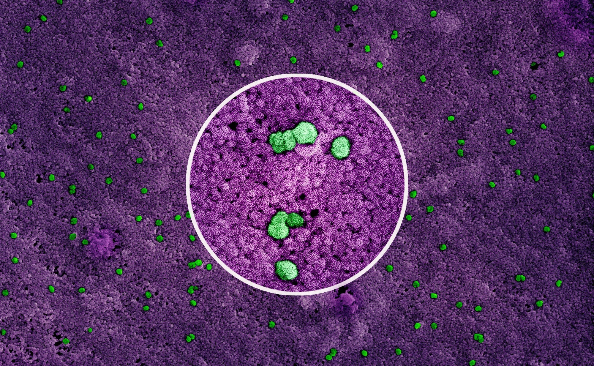 Study: A broadly generalizable stabilization strategy for sarbecovirus fusion machinery vaccines. Image Credit: NIAID