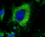 Pioneering Live Cell Imaging - Yokogawa's Impact and Innovations