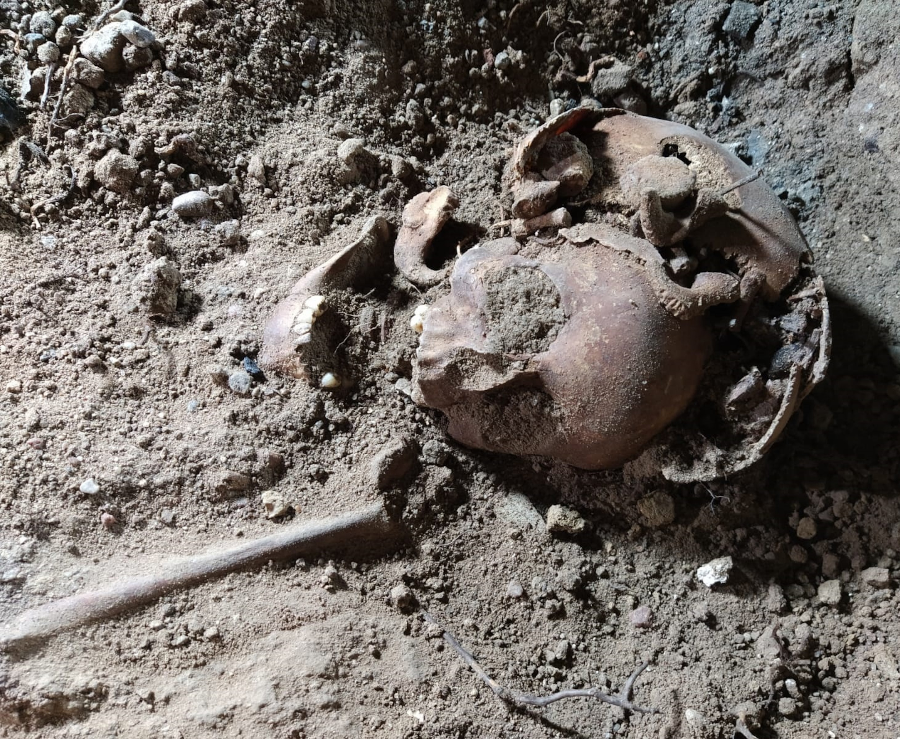 A skull is visible can be seen amongst the dirt.