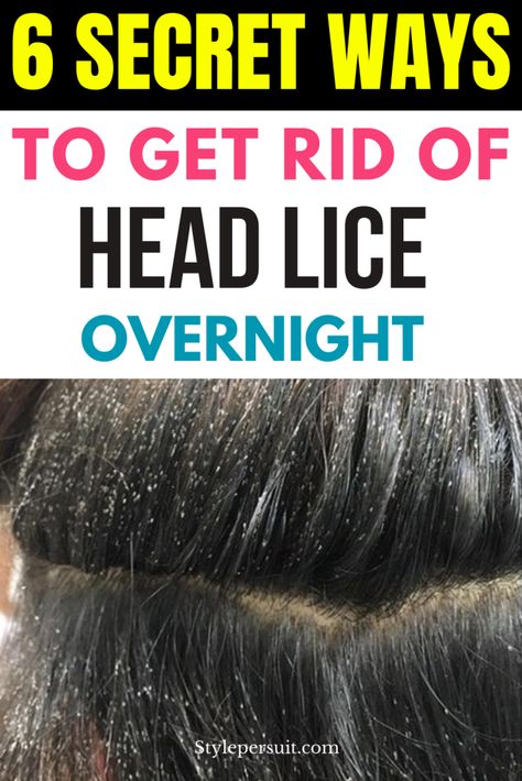 Natural Remedies For Lice And Nits, Essential Oil For Lice Removal, Diy Lice Spray For Hair, Lice And Nits Remedies, How To Remove Lice From Head, Hair Lice Remedies How To Get Rid, Lice Hair Removal, Best Way To Get Rid Of Lice And Nits, Essential Oils For Lice Removal