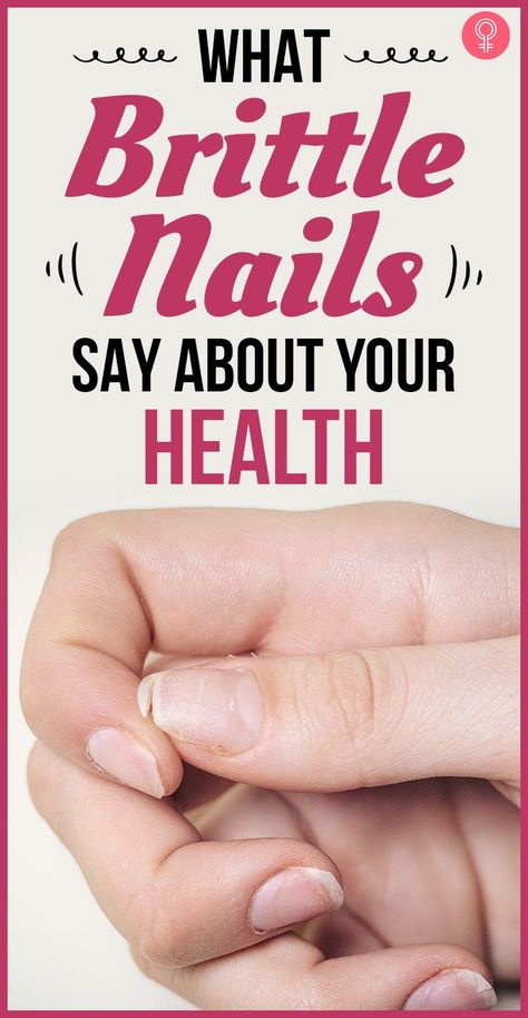 Nail Growth Tips, Grow Nails Faster, Food Nails, Weak Nails, Natural Acne, Menstrual Health, Tongue Health, Nose Shapes, Health Signs