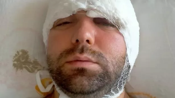 Ramazan Yılmaz in hospital after his 'botched' surgery
