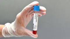 test tube with covid blood sample