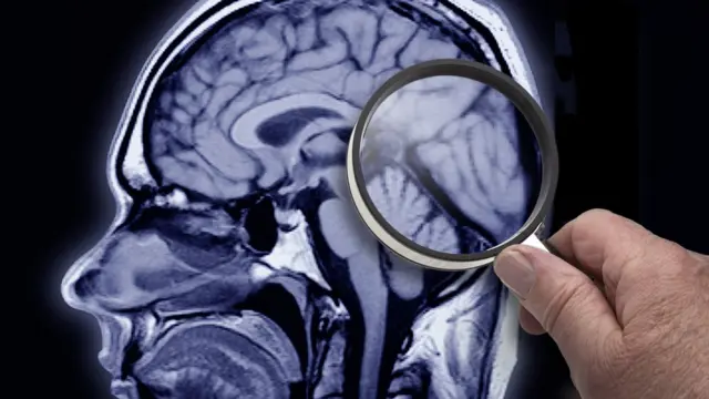 Изучение МРТ-снимка мозга через лупу