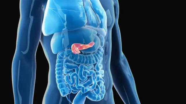 Medical illustration of di pancreas