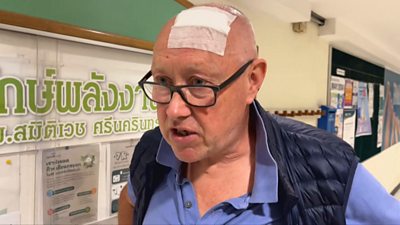 Man with head bandage speaking