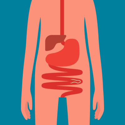 En grafisk bild med tarmsystemet där det finns en spolmask, i tarmen.