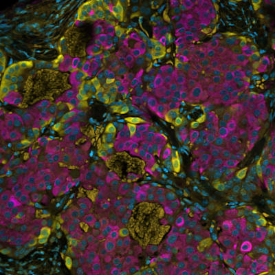 Bild på genredigerade stamceller.