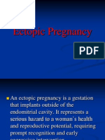 15b Ectopicpregnancy 090507104012 Phpapp02 130825152041 Phpapp01